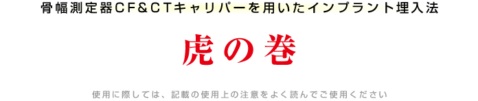 骨幅測定器CF&CTキャリパーを用いたインプラント埋入法 虎の巻